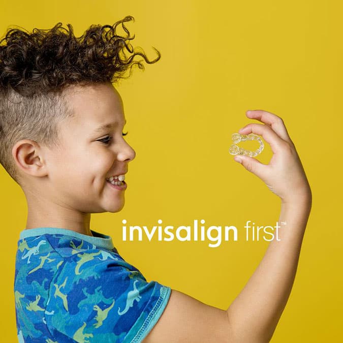 invisalign-first -phuong-phap-chinh-rang-tu-som-cho-tre